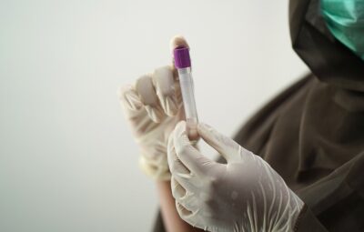 Free photos of Blood test